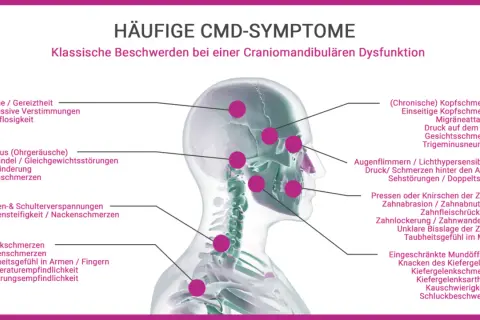 CMD-Symptome: Kiefer angespannt, Psyche beeinflusst durch Kopfschmerzen, Tinnitus, Nackenverspannungen und mehr.