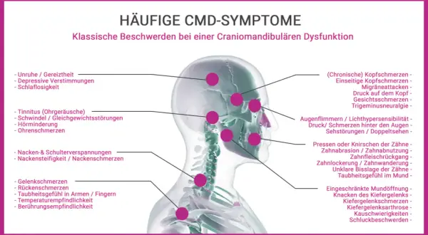 CMD-Symptome: Kiefer angespannt, Psyche beeinflusst durch Kopfschmerzen, Tinnitus, Nackenverspannungen und mehr.