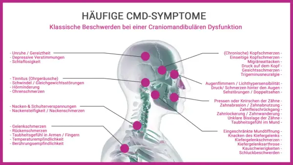 CMD-Symptome: Kiefer angespannt, Psyche beeinflusst durch Kopfschmerzen, Tinnitus, Nackenverspannungen und mehr.